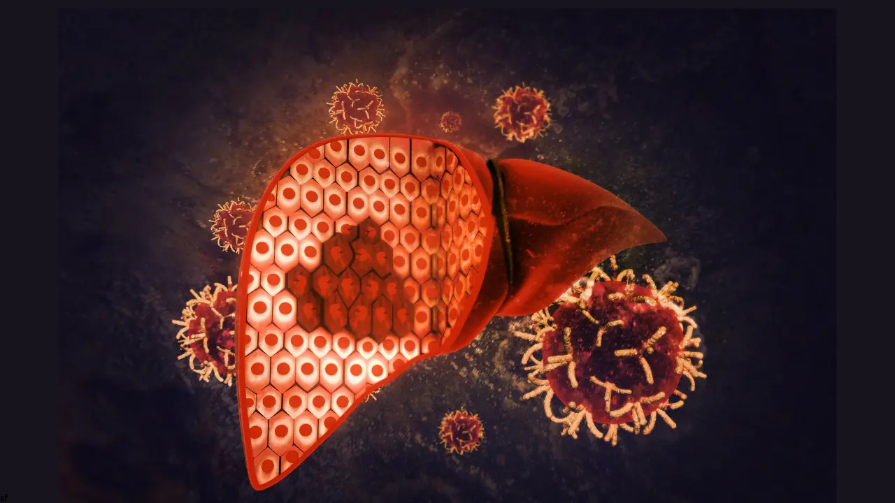 Chronic Liver Diseases